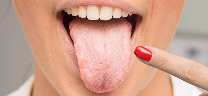 Candida: What It Is, Why It Happens & How to Naturally Rebalance Your Body (From the Inside Out)