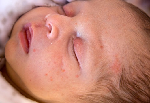 How to Support Your Baby’s Skin Barrier (A Gentle, Realistic Routine)