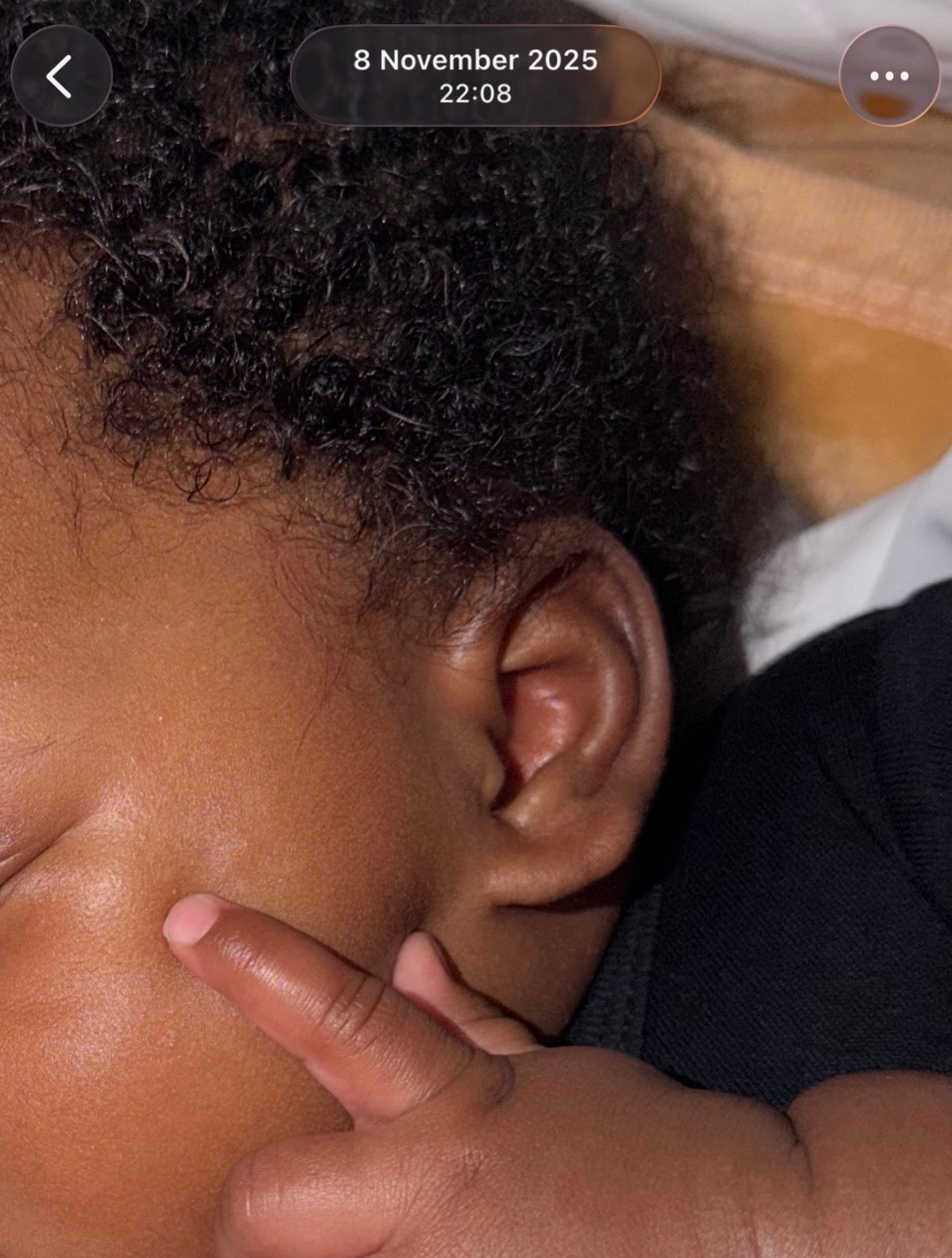 After — calmer baby skin