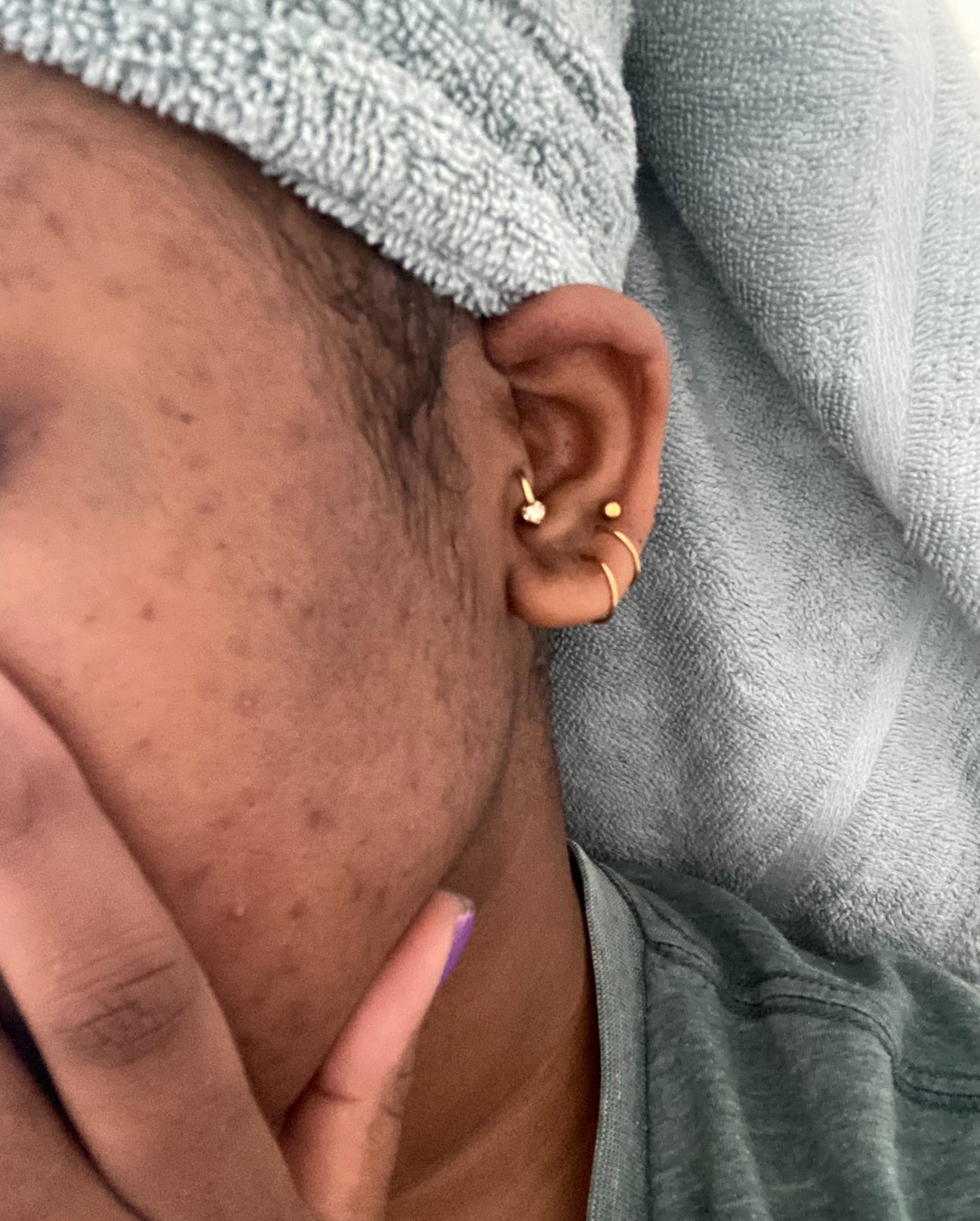 Before Sea Moss & Hormone Balance